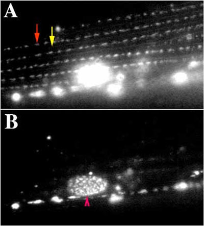 Localization of UNC-97::GFP within muscle body wall muscle Figure 6