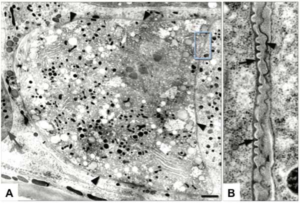  figure 14