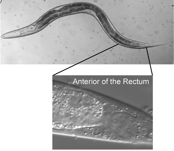 Normaski figure 15