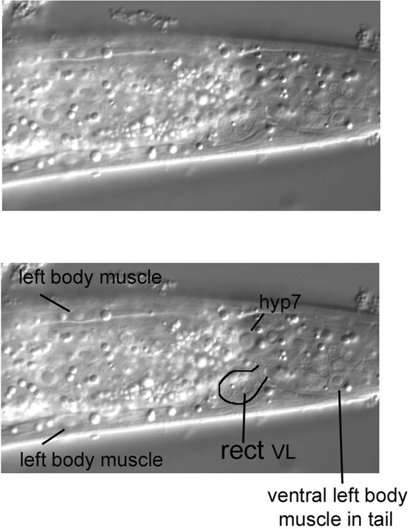 The characteristic nucleus and cell body of rect VL figure 17