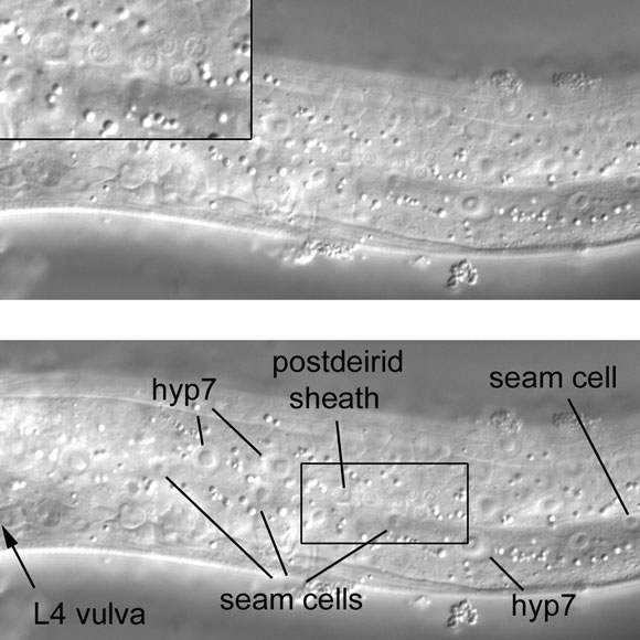 An isolated cluster of small nuclei (see inset) on the far left side of the posterior part of the middle body figure 21