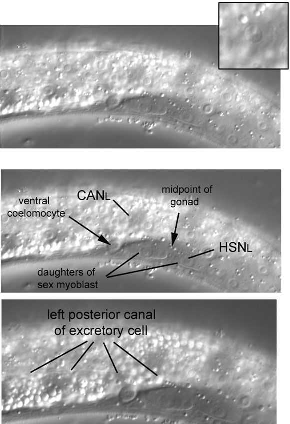 The dynamic Pn.p cells and sex myoblast of L3 larvae figure 32