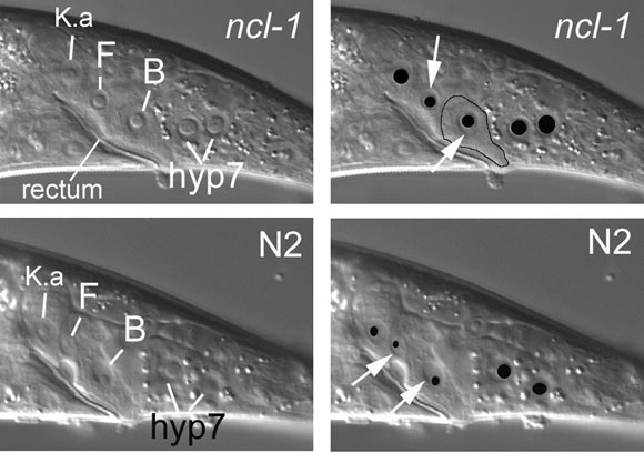 The Ncl phenotype figure 3