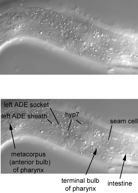 The far left side of the posterior half of the head figure 40