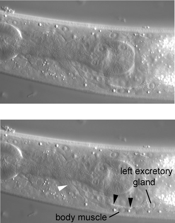 Near the central focal plane, the nucleus and anterior process of the left excretory gland figure 44