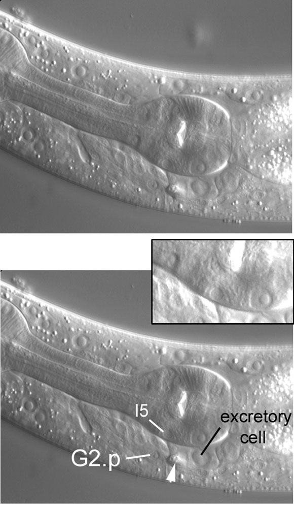 Nearer the central focal plane, the nucleus of G2.p, in this animal the likely excretory socket cell figure 45