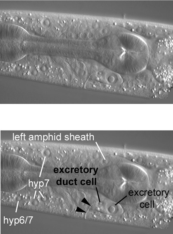 The nucleus of the excretory duct cell anterior of the prominent nucleus of the excretory cell figure 46