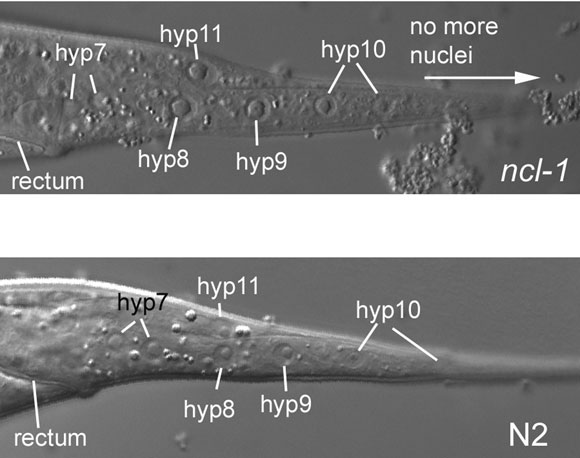 Another image of the Ncl phenotype figure 4