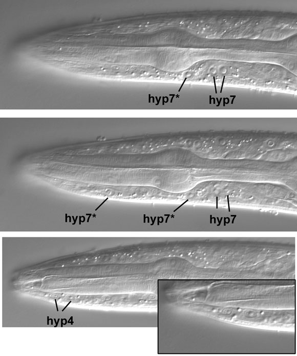 Ventral hypodermal nuclei in the central focal plane figure 51