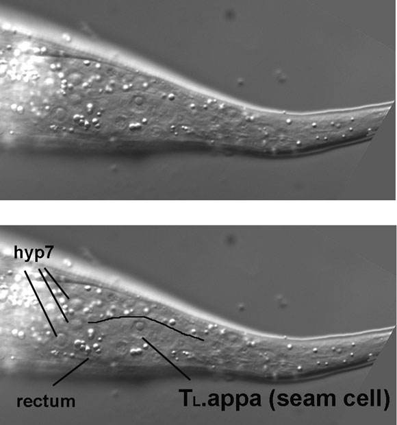 The extreme lateral nuclei of the tail figure 7