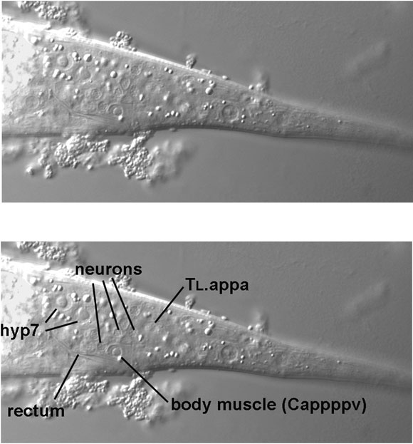 A ventral body muscle and cluster of neuronal cell bodies (the left lumbar ganglion) figure 9