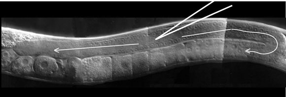 WormBook Worm Methods Transformation and Microinjection Figure 1