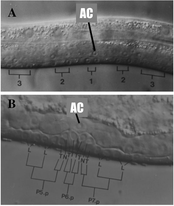 Nomarski images of developing vulva